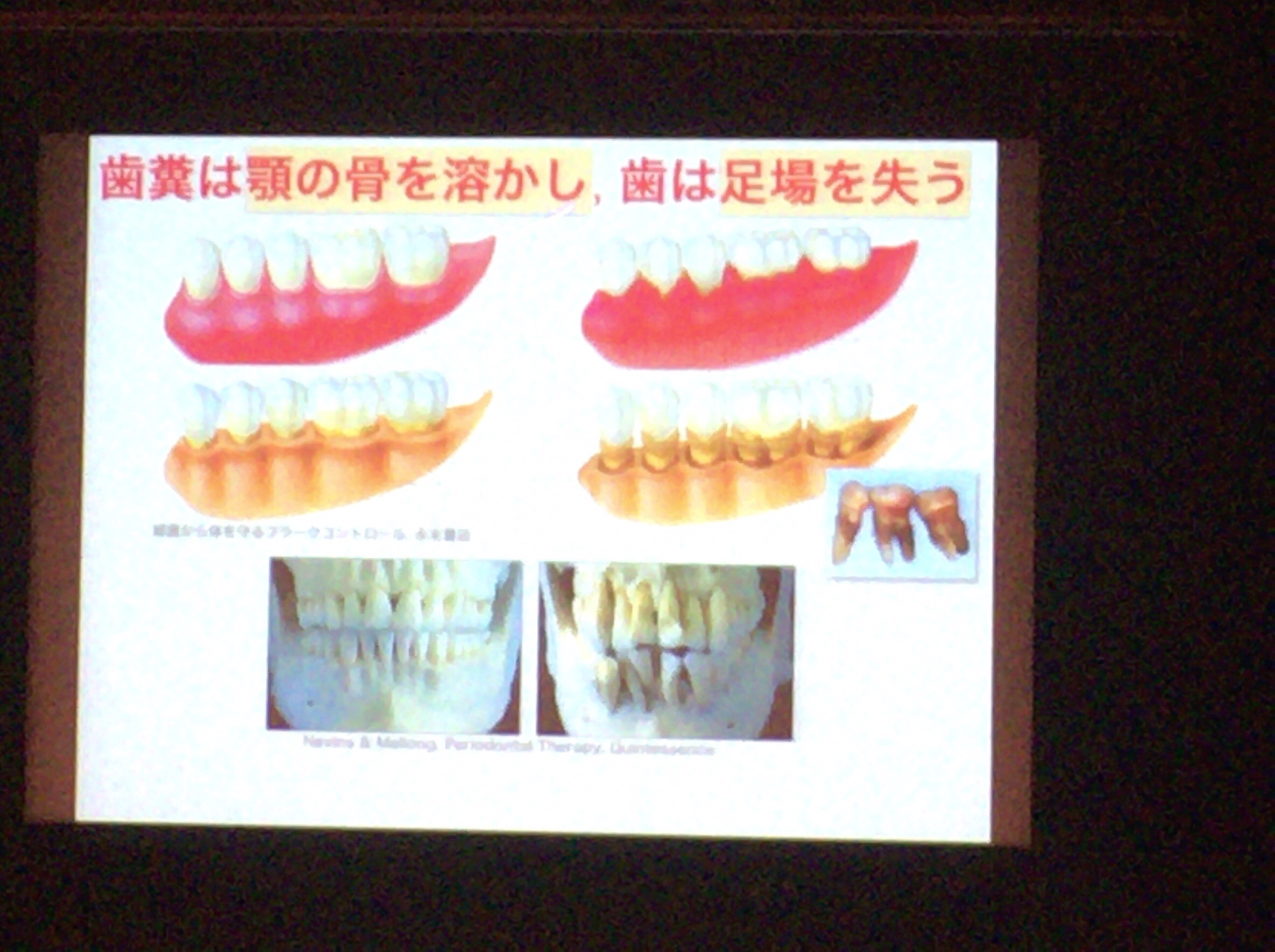 アンチエイジング歯科学会に行ってきました！