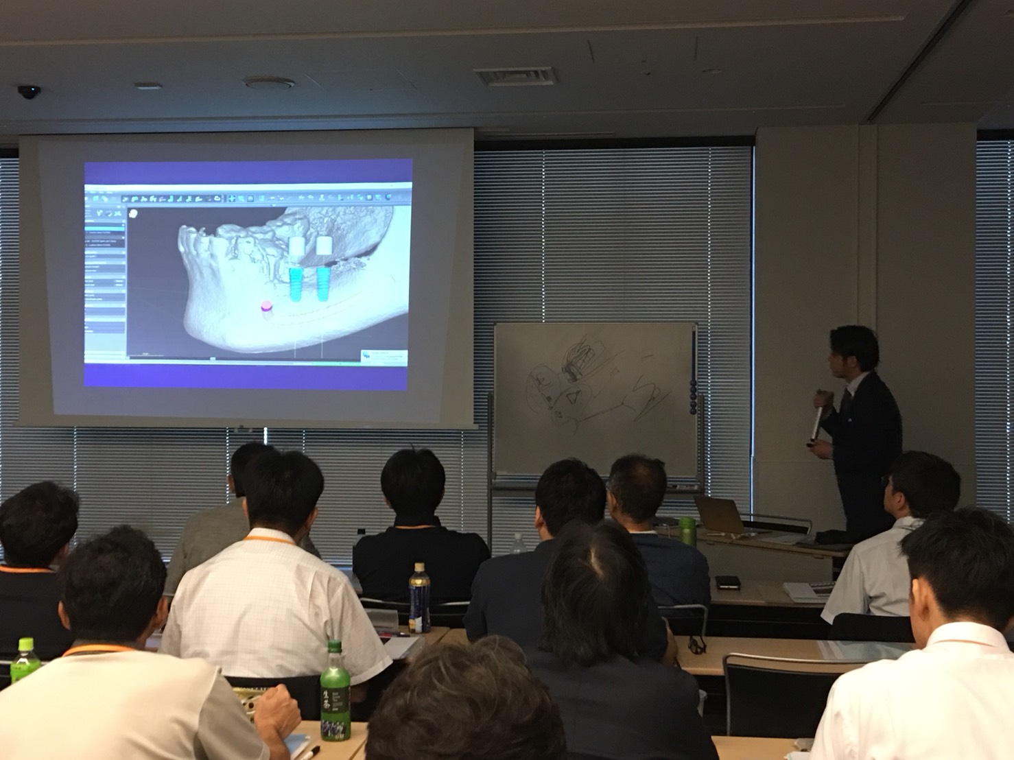 インプラントのセミナーにて