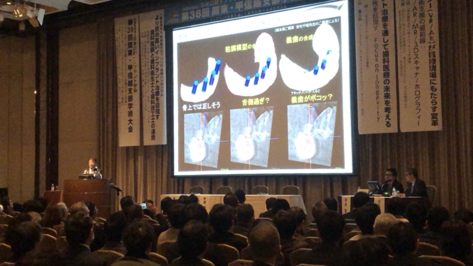 日本口腔インプラント学会