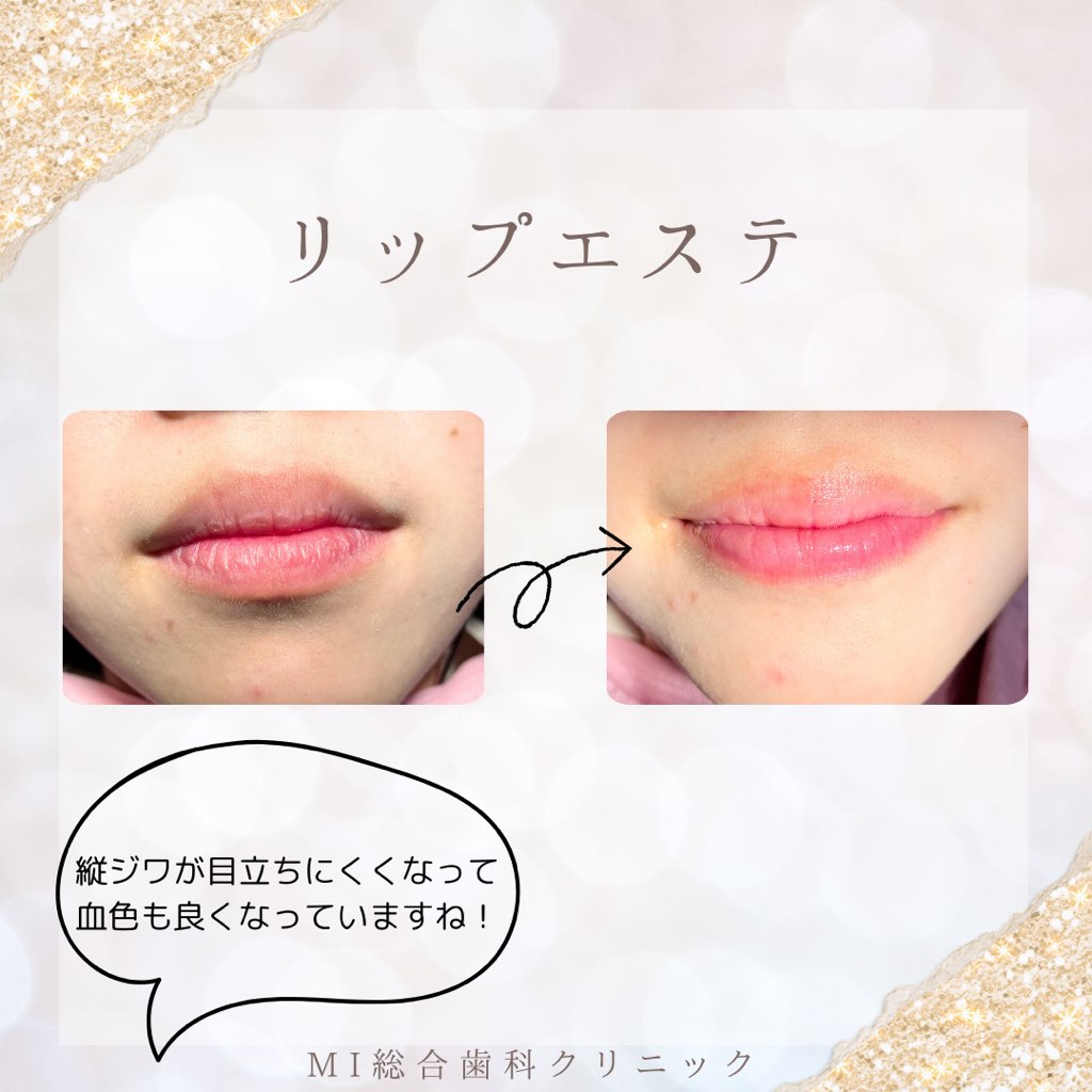 リップエステのご案内