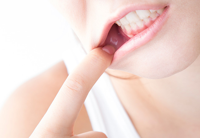 TCH（歯列接触癖）や歯ぎしりが顎関節症を招く可能性があります